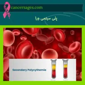 پلی سیتمی ورا