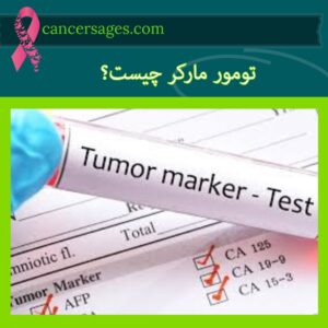 متخصصان سرطان 16 تومور مارکر