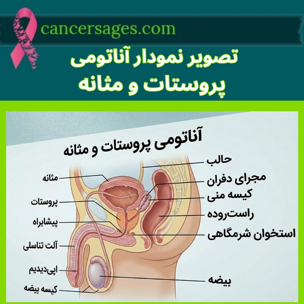 تصویر نمودار آناتومی پروستات و مثانه