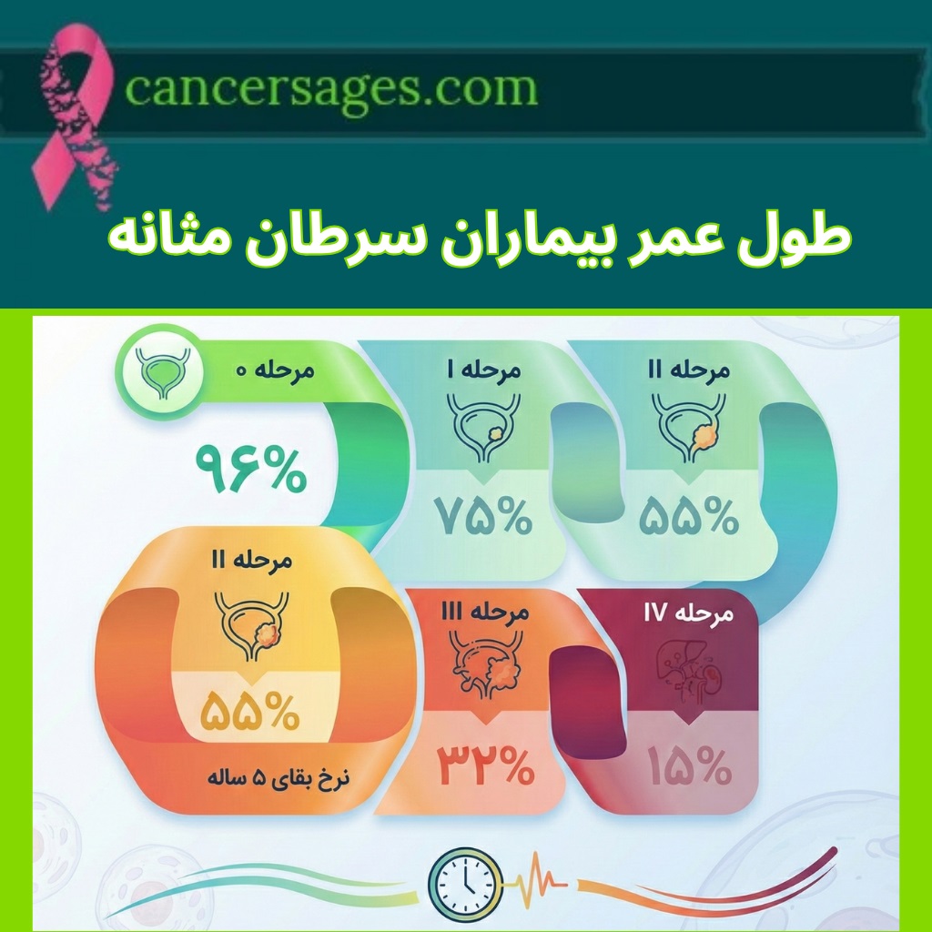 طول عمر بیماران سرطان مثانه