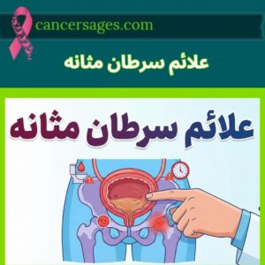 علائم سرطان مثانه