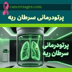 متخصصان سرطان 7 رادیوتراپی سرطان ریه