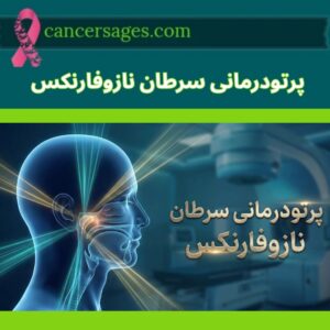 متخصصان سرطان 8 پرتو درمانی سرطان نازوفارنکس