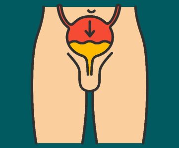 سرطان پروستات